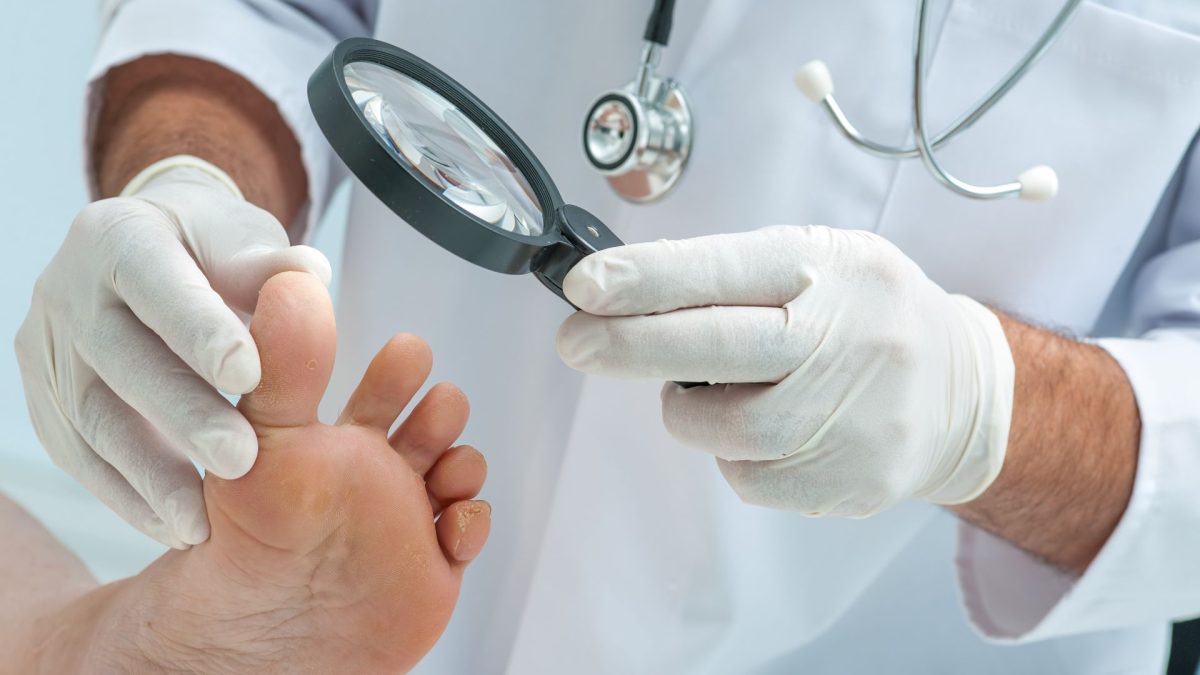 melanoma nail disease