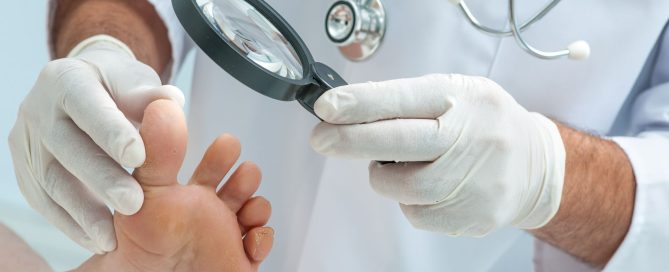 melanoma nail disease
